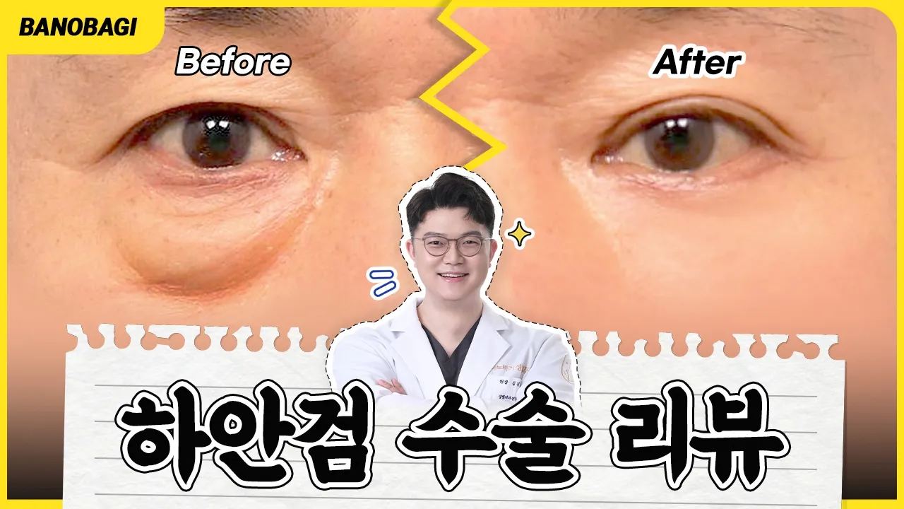 우리 엄마, 아빠도 해드려야지....💖 하안검 전후, 하안검 후기