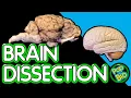 Sheep Brain Dissection Anatomy and Function