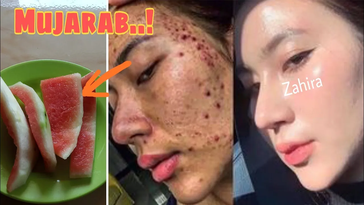 #review RIVIEW L'OREAL WHITE PERFECT CLINICAL Essence, Day Cream & Night Cream