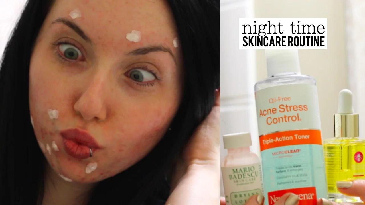 Night Time Skincare Routine | Acne Prone Skin