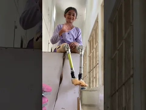 Artificial leg #prosthetics #heelpain #backpain #shorts #shortsfeed #shortsviral #hassanzarar legs