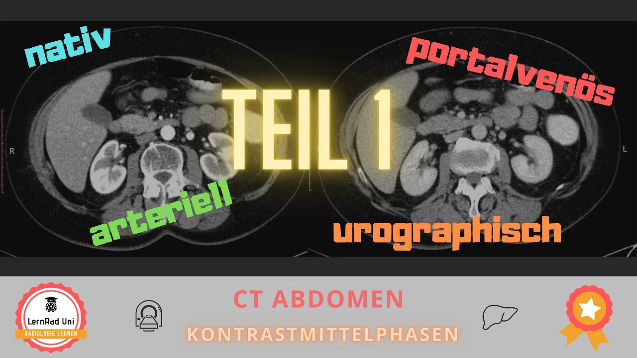 Kontrastmittelphasen in der CT einfach erklärt – Teil 1