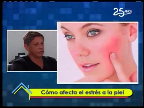 Cómo afecta el estrés a la piel