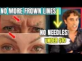 Download Lagu QUICKLY and EASILY GET RID OF YOUR FROWN LINES