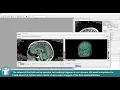 MeVisLab Tutorials - Application Development