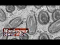 Monkeypox Demystified Should we be worried about the new outbreak
