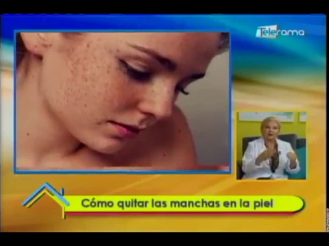 Cómo quitar las manchas de la piel