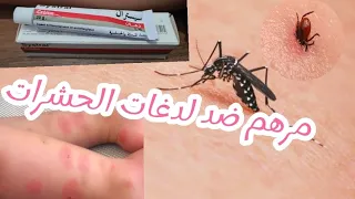 علاج عضة الناموس للاطفال Systral مرهم للحكة و حبوب و تقيحات جلدية بسبب عضة شنيولة 