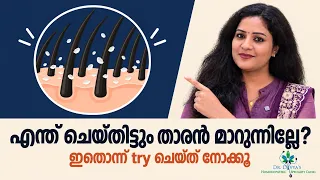 എന്ത് ചെയ്തിട്ടും താരൻ മാറുന്നില്ലേ ഇതൊന്ന് try ചെയ്ത് നോക്കു Say Goodbye to Stubborn Dandruff