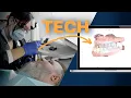 Same-Day Smile Science The Advanced Technology Behind ClearChoice s Transformative Implant System