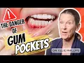 ELIMINATE Deep Cleanings - HEAL Gum Pockets At Home