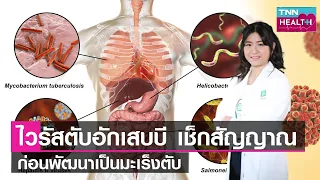 วิธีป้องกันการติดเชื้อไวรัสตับอักเสบ B ทำอย่างไรบ้าง และใครควรได้รับวัคซีน
