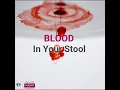 Download Lagu Rectal Bleeding | Call 800 55 | Burjeel Day Surgery Center, Al Reem Island
