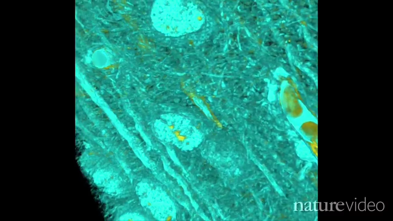 Untangling the brain - by Nature Video