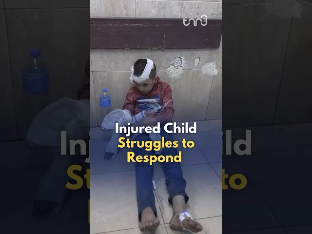 ⁣A severely injured child falls in and out of consciousness.