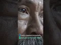 Download Lagu This Symptom May Be an Early Sign of Parkinson’S Disease Part 1 #Sharecare #Shorts