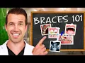 How do BRACES actually work