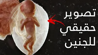 تصوير حقيقي لجنين بشري ينمو داخل الرحم بتقنية رباعية الابعاد 