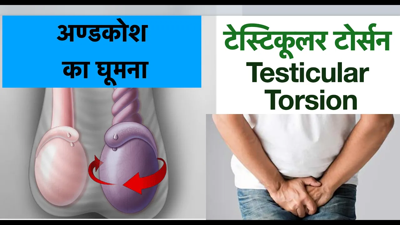 Testicular Torsion I TESTES PAIN I Testes swelling