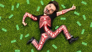 EU QUEBREI TODOS OS OSSOS DO MEU CORPO PRA GANHAR UM MILHÃO DE REAIS!
