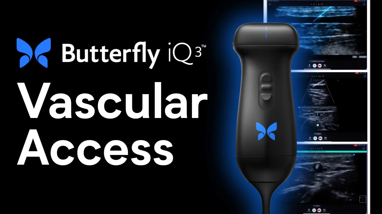 Butterfly iQ3 product ad