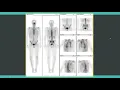 Crash course in nuclear medicine for radiology exam preparation