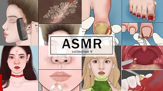 20 MINUTES Satisfying ASMR | Scalp Scaling, Ingrown Toenail, Blackheads, Tonsil Stone Removal