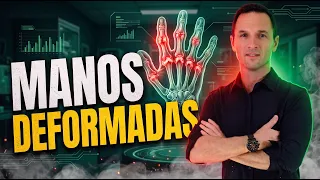¿Se te están DEFORMANDO las manos? La causa intestinal que nadie te cuenta