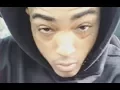Xxxtentacion Reveals Rob Stone Wasn t Person Who Knocked Him Out