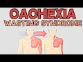 Cachexia - Wasting Syndrome