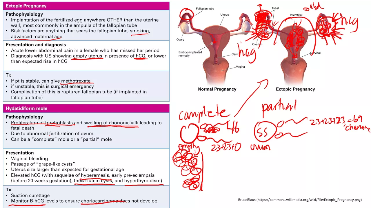 Pregnancy Pathology | Reproductive system | Step 1 Simplified