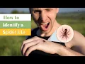 Identifying Spider Bites How to Recognize and Treat Spider Bite Symptoms The Guardians Choice