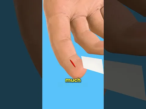 Why Paper Cuts Hurt So Bad?! 😖