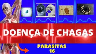 DOENÇA DE CHAGAS - TRYPANOSOMA CRUZI (BARBAEIRO) - PARASITOLOGIA | INFECTOLOGIA