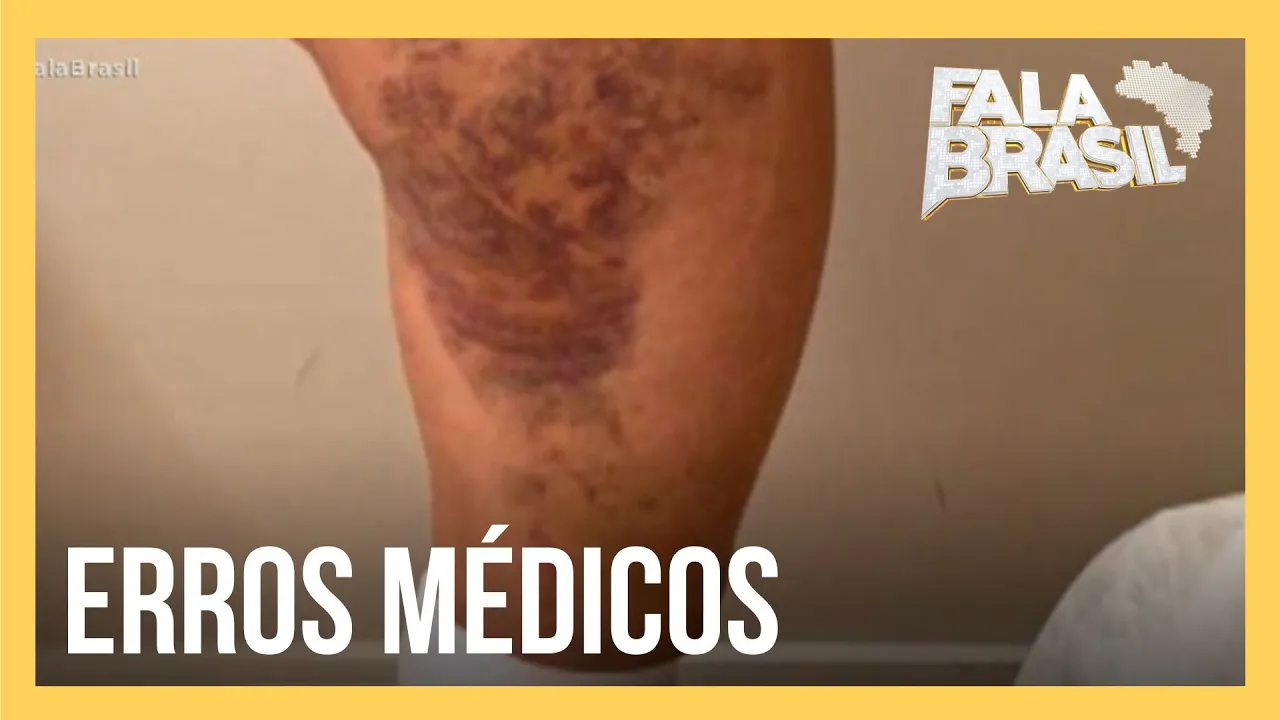 Mulheres sofrem com as sequelas de erros médicos em cirurgias plásticas