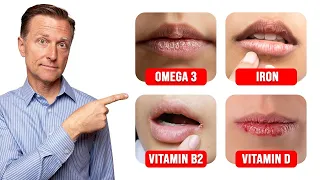 Download 5 Things Your LIPS Can Tell You about Your Nutritional State MP3