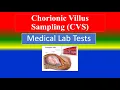 CHORIONIC VILLUS SAMPLING CVS -