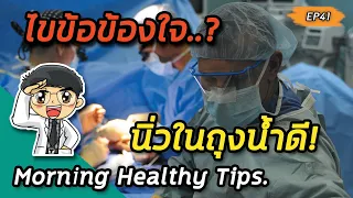 นิ่วในถุงน้ำดีควรรักษาเมื่อไหร่ และมีวิธีการรักษาอย่างไร?