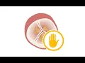 Prophylactic antibiotic treatment to prevent infective endocarditis