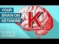 Download Lagu What Ketamine Actually Does To Your Brain | Insider Science
