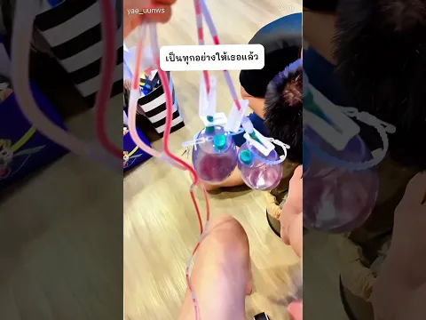 อัพเดต แก้นมเหล่ ครบ 2 ปีครึ่ง #แก้หน้าอก #ศัลยกรรม #ทำนม @TheKliniqueMedicalClinic