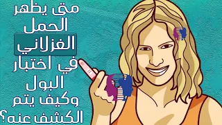 إذا شك يت بالحمل المصاحب للدورة الشهرية فمتى يظهر الحمل الغزلاني في اختبار البول وفي السونار 