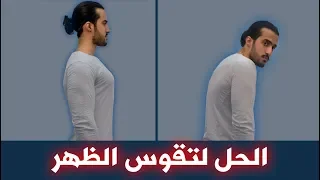   تمارين تعدل تقوس الظهر وتخلي وقفتك زي الحصان في ثلاثة أسابيع    دندنها