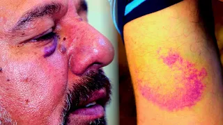 حلقة كاملة شاب يطـ عن ابوه بالســ كين واشد انواع الـــ ضرب بحق الام بسبب الســ حر 