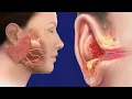 Swollen Preauricular Lymph Nodes Causes And Treatment