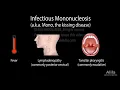 Infectious Mononucleosis (Mono) - the Kissing Disease, Animation