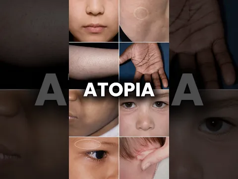 ¡Alerta! Señales en tu piel que pueden revelar que eres atópico(a). #dermatologia #dermarologo