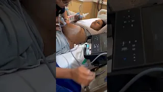 تعديل الوضع المقعدي 