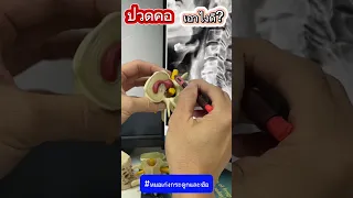  ทำไมคนอายุ 20-30 ปีขึ้นไปถึงมีอาการปวดคอ ปวดไหล่ และชาลงแขน 