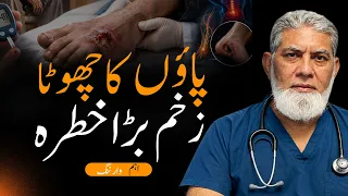 Paon Ka Zakhm Theek Nahi Ho Raha? Warning Signs Ignore Na Karein 🔴 | By Prof. Dr. Javed Iqbal